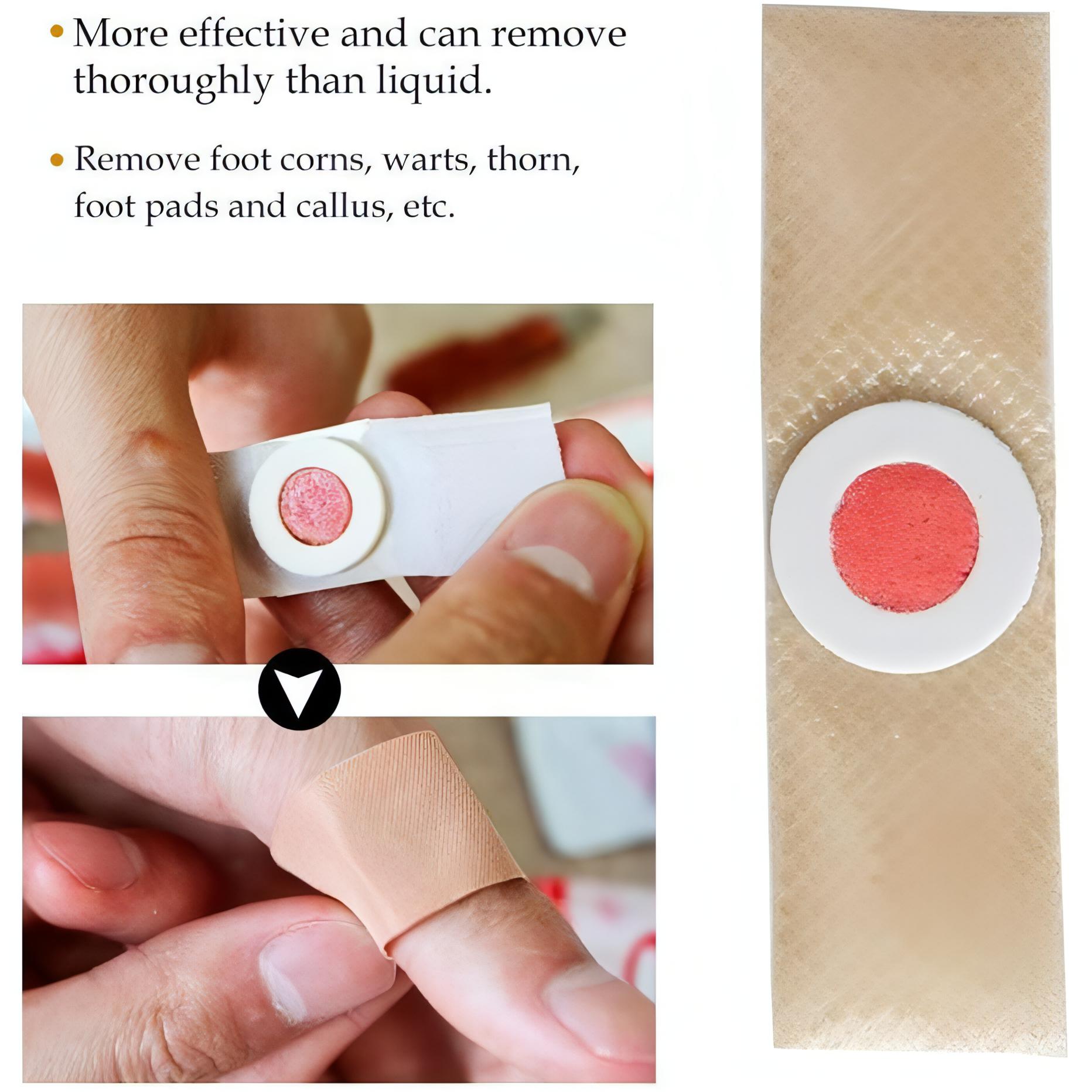 Corn Remover Pads | Remove Foot Corns Fast, Protection Against Shoe Pressure - NextMamas