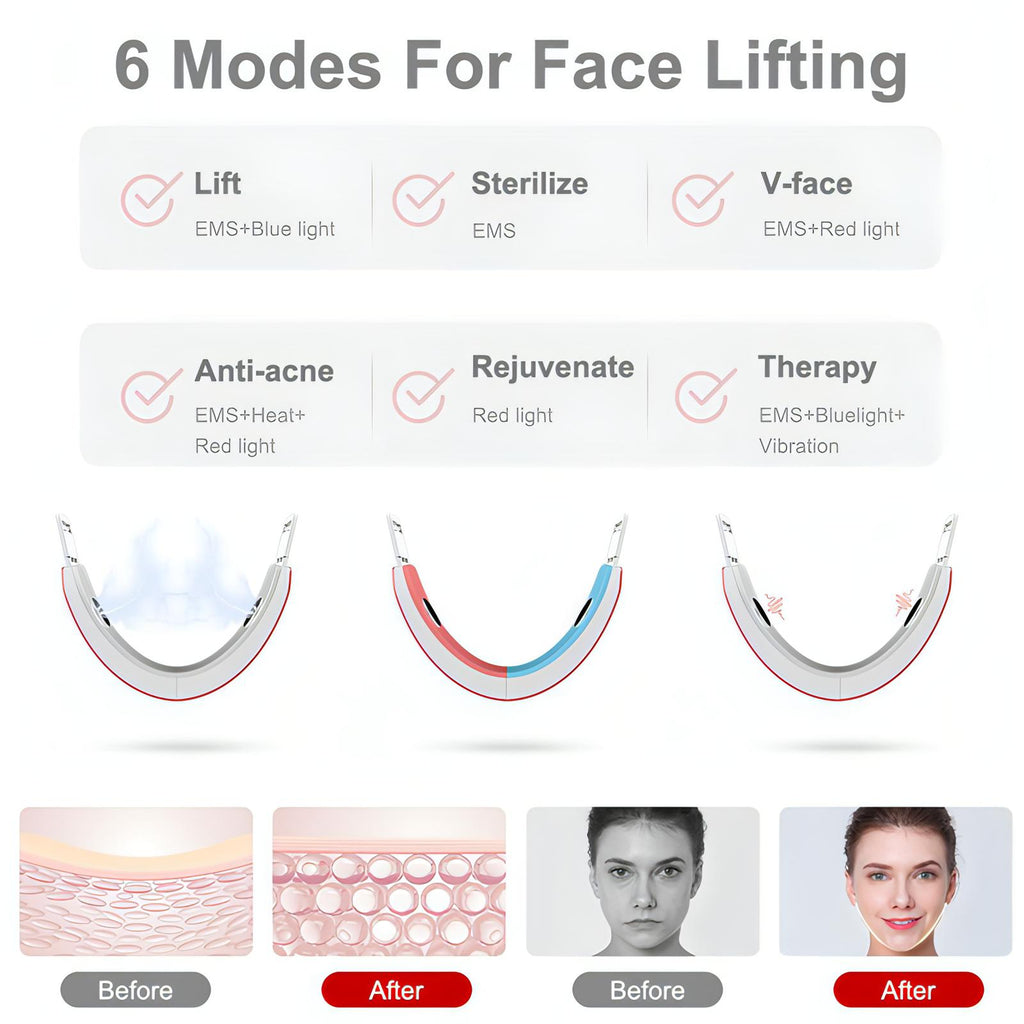 Infrared Face‑lifting Vibrating Belt | Remove Double‑Chin, Sin Glow, Tightening & Skin Lift - NextMamas