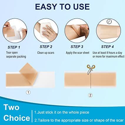 Scar Removal Silicone Gel Sheet | Fades C-Section Scars, Acne Scars, Wound & Operation Scars - NextMamas