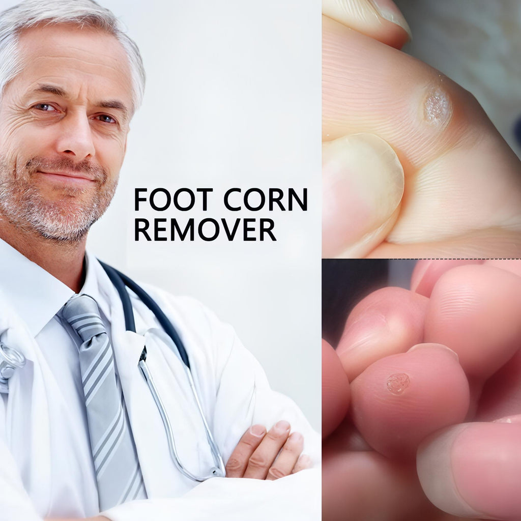 Corn Remover Pads | Remove Foot Corns Fast, Protection Against Shoe Pressure - NextMamas