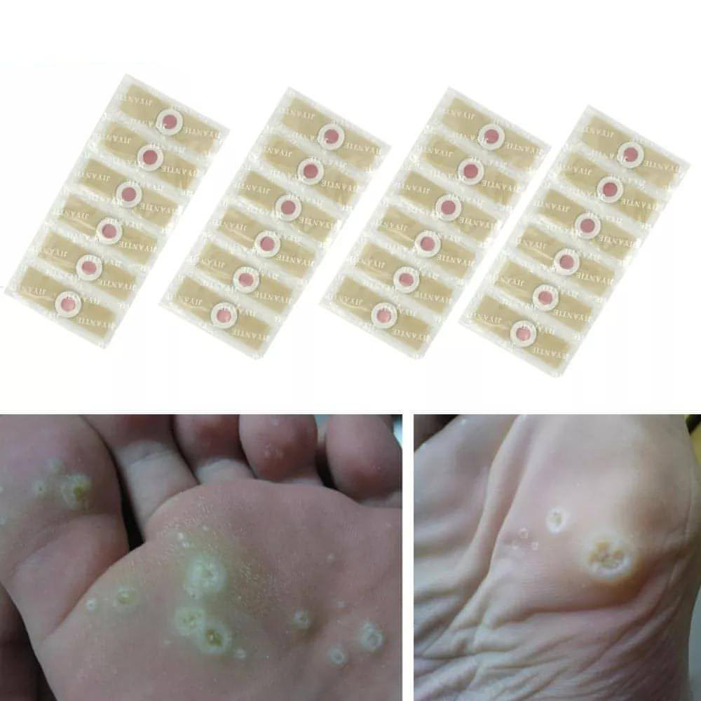 Corn Remover Pads | Remove Foot Corns Fast, Protection Against Shoe Pressure - NextMamas