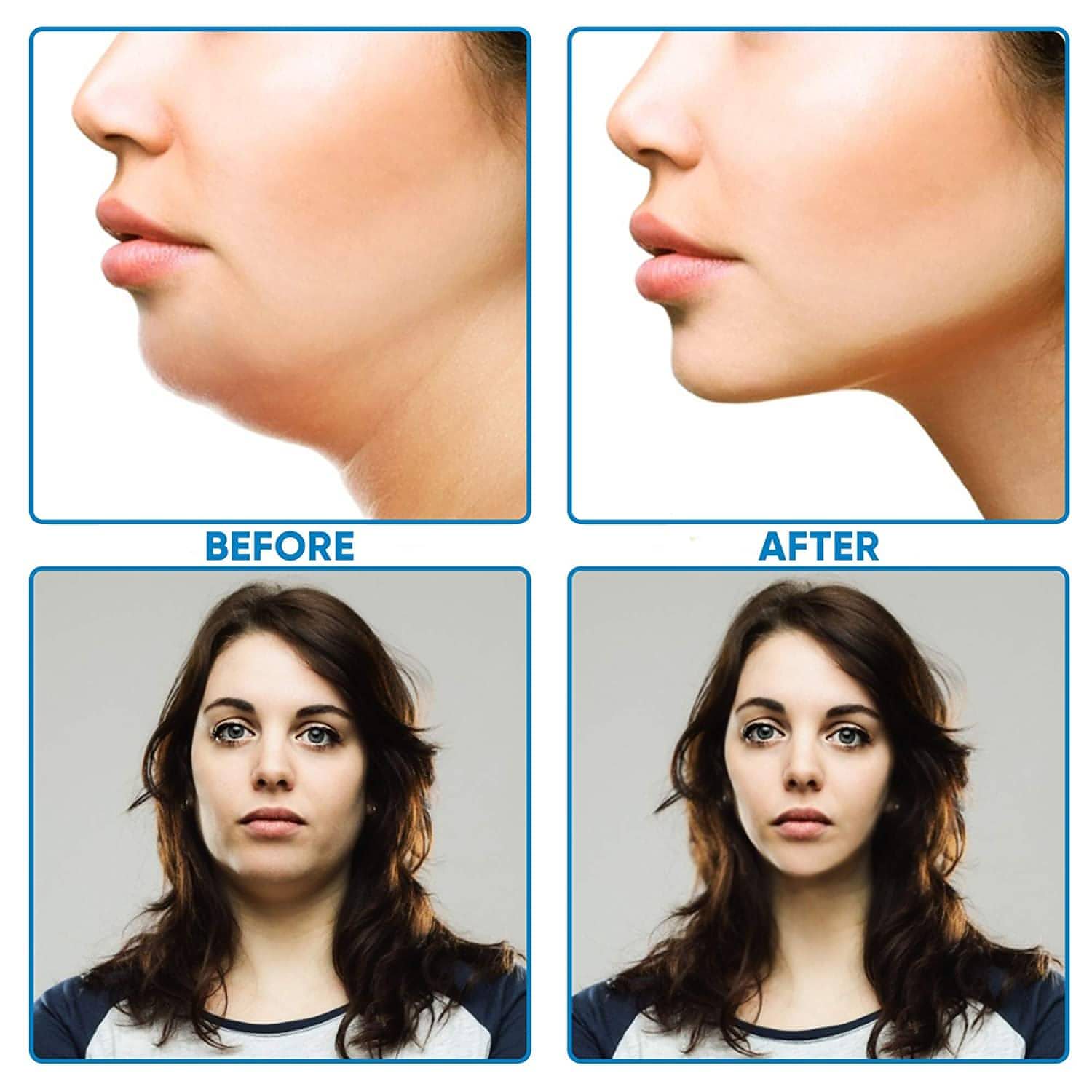 Facial Slimming Strap, Double Chin Reducer, V line face lifting