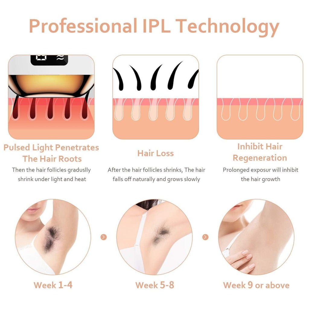 IPL Laser Hair Removal Device | Permanent Hair Remover On Face, Legs, Arms, Armpits, Whole Body | Use at Home - NextMamas