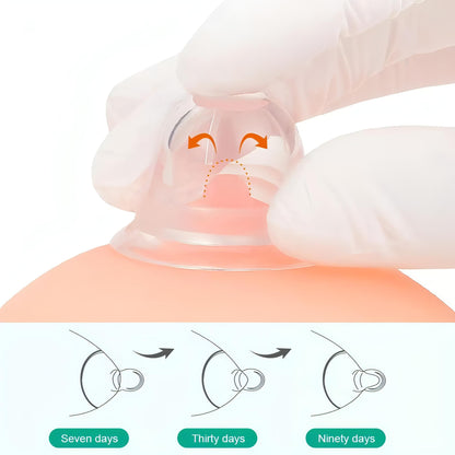 Nipple Puller For Breastfeeding | Nipple Corrector for Inverted and Flat Nipples - NextMamas