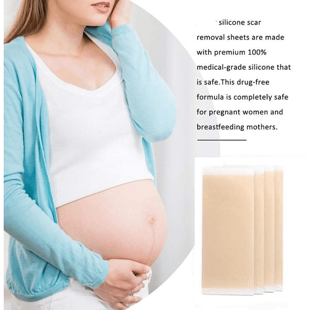 Scar Removal Silicone Gel Sheet | Fades C-Section Scars, Acne Scars, Wound & Operation Scars - NextMamas