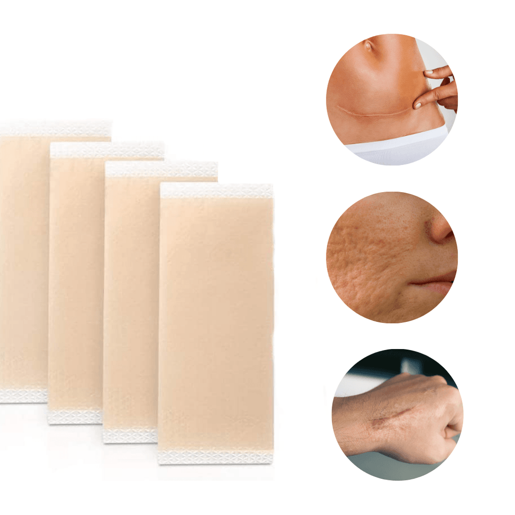 Scar Removal Silicone Gel Sheet | Fades C-Section Scars, Acne Scars, Wound & Operation Scars - NextMamas